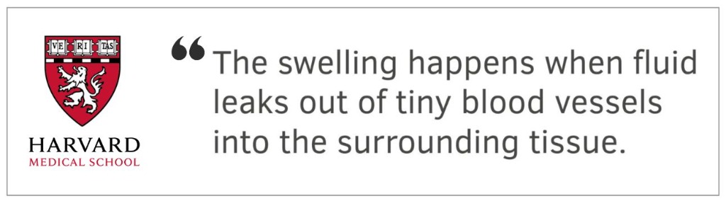 Harvard Medical School: The swelling happens when fluid leaks out of tiny blood vessels into the surrounding tissue.