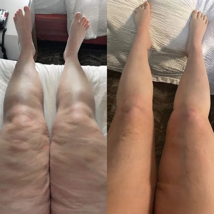Melissa T. — before and after